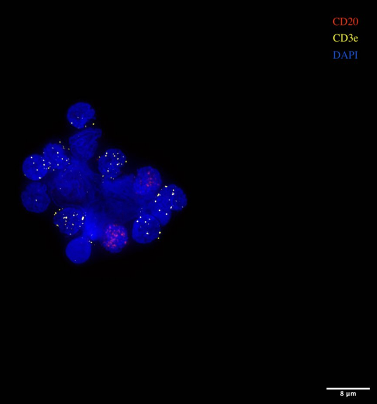Molecular Instruments (@hcrimaging) on Twitter photo This week’s #onlywithHCR Spotlight features <a href="/CalebLareau/">Caleb Lareau</a>, <a href="/tsion_abay/">Tsion Abay</a>, <a href="/MerilTakizawa/">Meril Takizawa</a>, @ChaligneRonan, and Bob Stickels!
#HCRimaging’s effective suppression of non-specific binding and high signal-to-background ratio allowed them to detect rare populations of cells and nuclei This week’s #onlywithHCR Spotlight features <a href="/CalebLareau/">Caleb Lareau</a>, <a href="/tsion_abay/">Tsion Abay</a>, <a href="/MerilTakizawa/">Meril Takizawa</a>, @ChaligneRonan, and Bob Stickels!
#HCRimaging’s effective suppression of non-specific binding and high signal-to-background ratio allowed them to detect rare populations of cells and nuclei