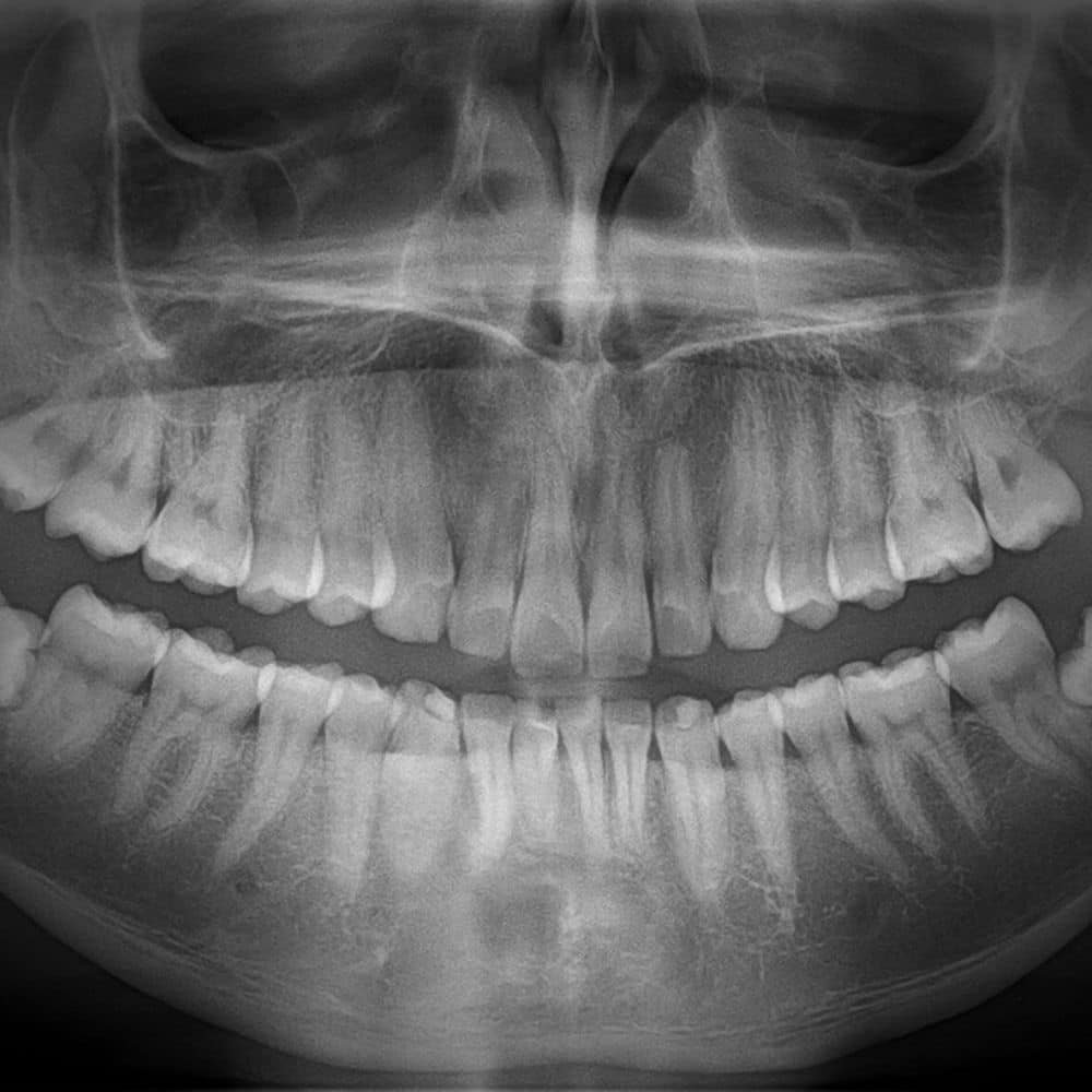 En los últimos años, un número creciente de estudios han respaldado una hipótesis alarmante: El Alzheimer no es una enfermedad, es una infección 😧