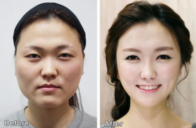 Many Chinese medical tourists who go to South Korea for inexpensive and high-quality plastic surgery have difficulty re-entering China due to their passports photos not matching their new face post op.