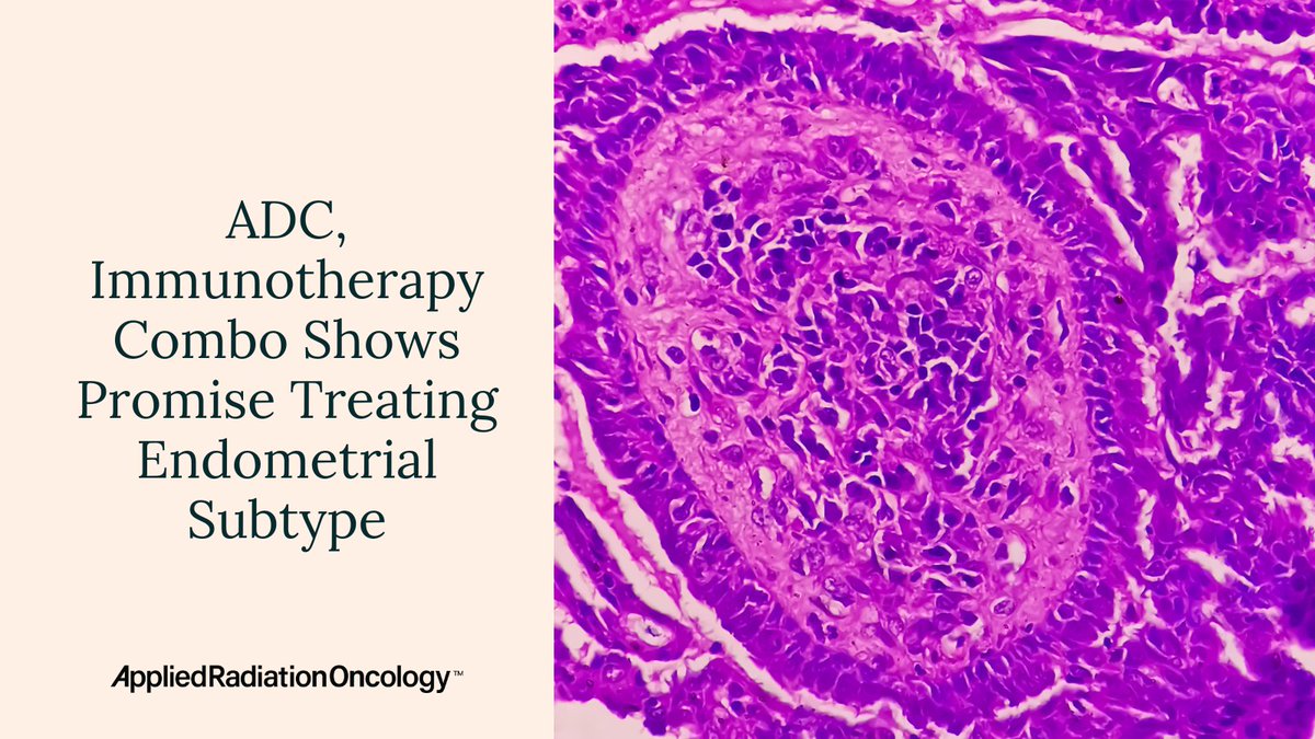 In a small, investigator-initiated phase 2 study, a novel combination of an antibody-drug conjugate and an immune checkpoint inhibitor showed notable activity in pre-treated patients with a difﬁcult-to-treat form of #endometrialcancer Learn more ➡️ bit.ly/3Wa8OHa #NWHW