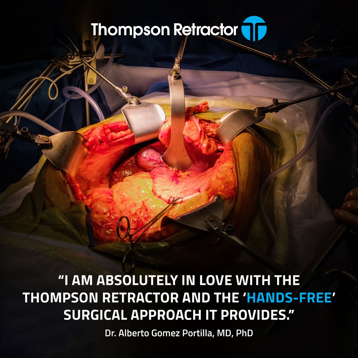 Hear directly from a surgeon on why they choose Thompson. 'I am absolutely in love with the Thompson Retractor and the 'hands-free' surgical approach it provides.' - Dr. Alberto Gomez Portilla, MD, PhD. Thanks Dr.!
#liversurgery #surgeontestimony #thompsonretractor #livertwitter