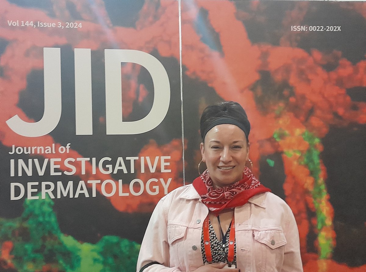 Journal of Investigative Dermatology (@thejidjournal) on Twitter photo Thank you <a href="/PerezWhiteLab/">Dr. Bethany E. Perez White</a> for visiting the JID Lounge at the #SID2024Dallas meeting. Perez White et al's paper doi.org/10.1016/j.jid.… will be published in the August issue of JID.
Come and collect your #JIDBandana and #fanabandana in Dallas!
#derm #dermatology #dermtwitter Thank you <a href="/PerezWhiteLab/">Dr. Bethany E. Perez White</a> for visiting the JID Lounge at the #SID2024Dallas meeting. Perez White et al's paper doi.org/10.1016/j.jid.… will be published in the August issue of JID.
Come and collect your #JIDBandana and #fanabandana in Dallas!
#derm #dermatology #dermtwitter