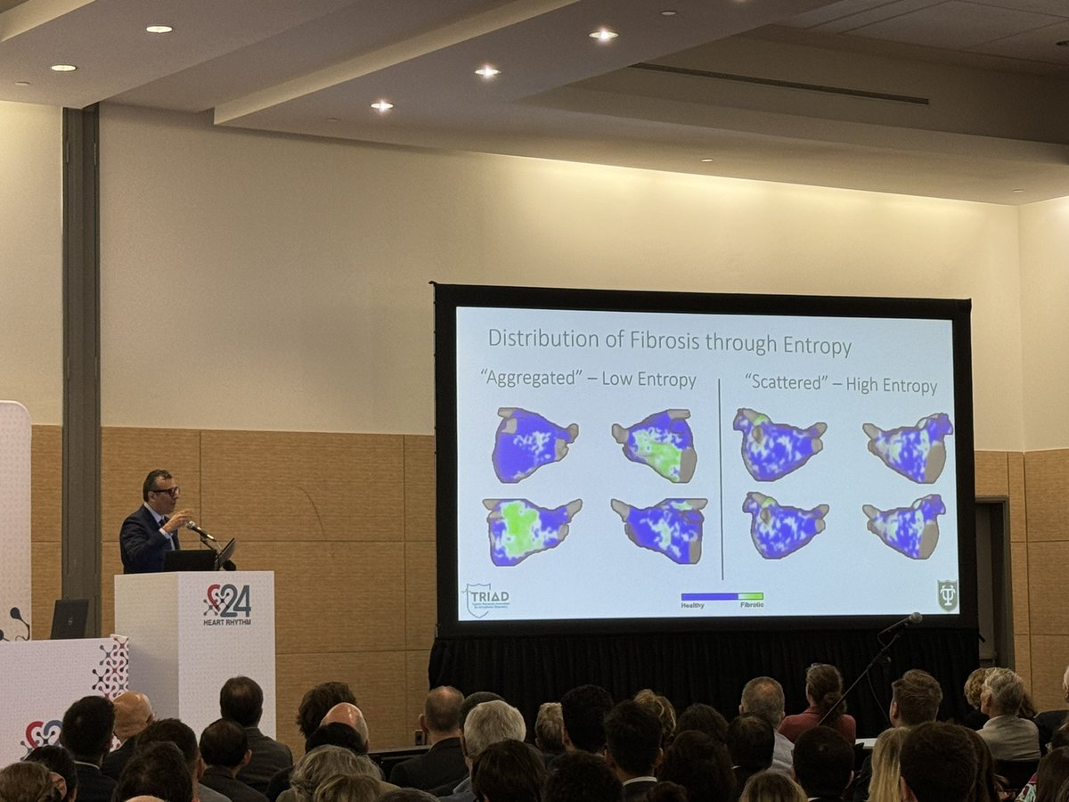 The volume of Fibrosis is important, but the distribution of Fibrosis also matters. @nmarrouche just presented a new TRIAD findings about fibrosis Entropy. For more details, check out the poster session on Saturday, May 18th 10:30-12:30 @AlaAssaf3 will answer your questions!