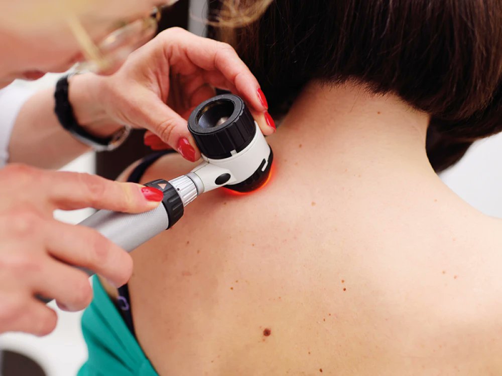 May is Skin Cancer Awareness Month – here's what to look out for and where to go for help livingnorth.com/article/what-y…