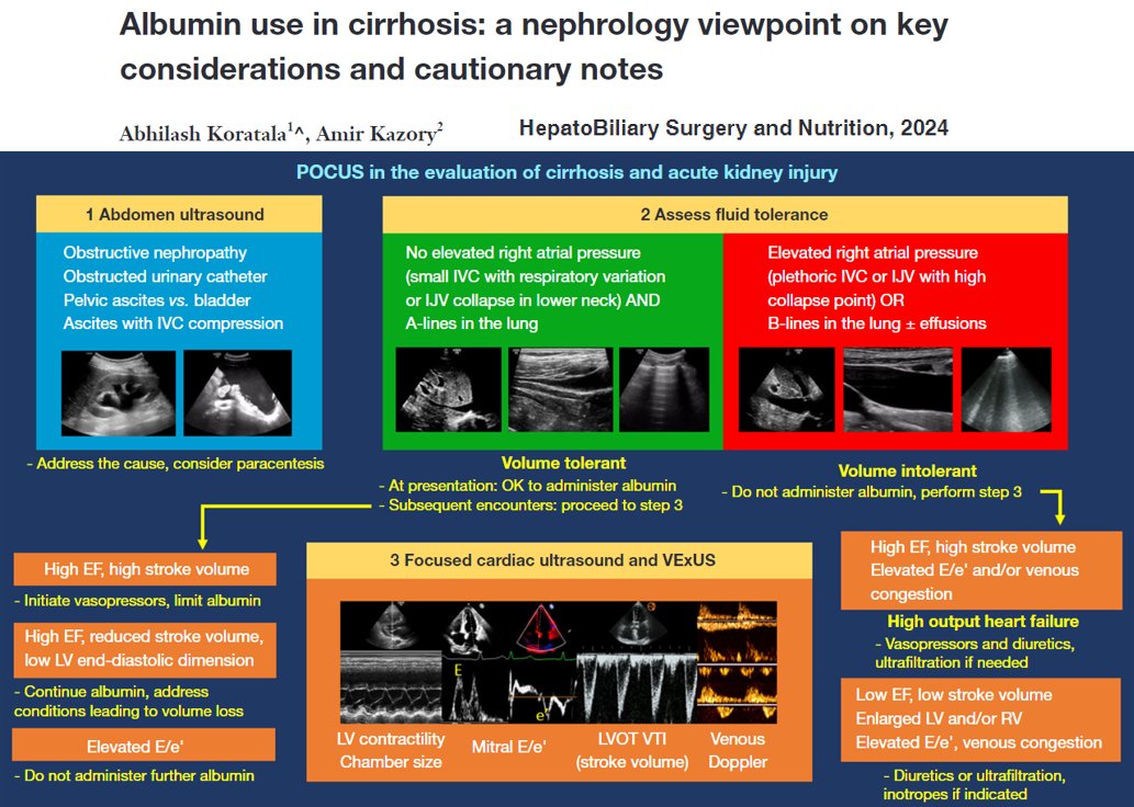 #POCUS #hepatorenal #Nephpearls I'm pleased to have contributed this invited editorial in @HepatobiliaryN alongside Professor @AmirKazory. It's logical 🧠 to perform a physical exam (#POCUS) before empirically administering albumin in cirrhosis + #AKI. 🔗hbsn.amegroups.org/article/view/1…