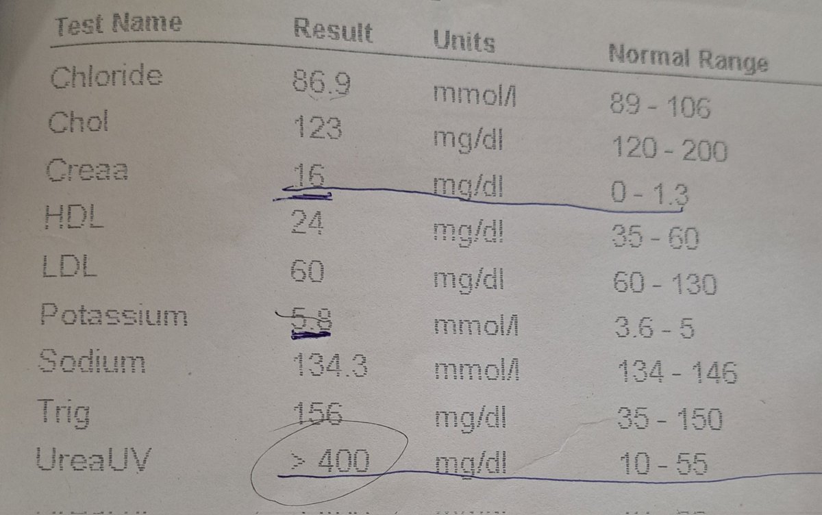 8yrs/F referral AKD [ATN] 2⁰ Severe Malaria with Hemolytic Anemia, Anuric 8 days, Uremic gastritis, & Encephalopathy 🧪Creat 16mg, Urea >400mg/dl 😕 Note, Uremic frost AKD is a continum of AKI & we need to halt its progression to CKD using our improvised #PeritonealDialysis