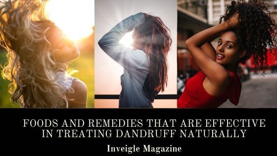 Tired of constantly scratching your itchy scalp? These natural foods and remedies can help soothe and treat dandruff. inveiglemagazine.com/2020/04/foods-… #HealthyHair #NaturalTreatment #DandruffFree #DandruffTreatment #NaturalRemedies