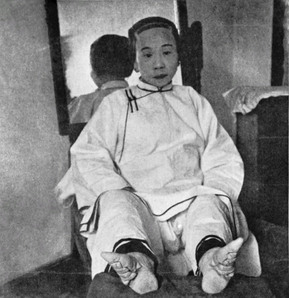 Çocukluğundan beri ayakları bağlı olan Çinli bir kadın. 1800'lerin sonu