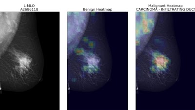 What's needed to generalize a #DeepLearning model for screening mammography? doi.org/10.1148/ryai.2… @DrLaurenOR @drjamescondon @AdelaideSPH #DL #BreastCancer #MachineLearning