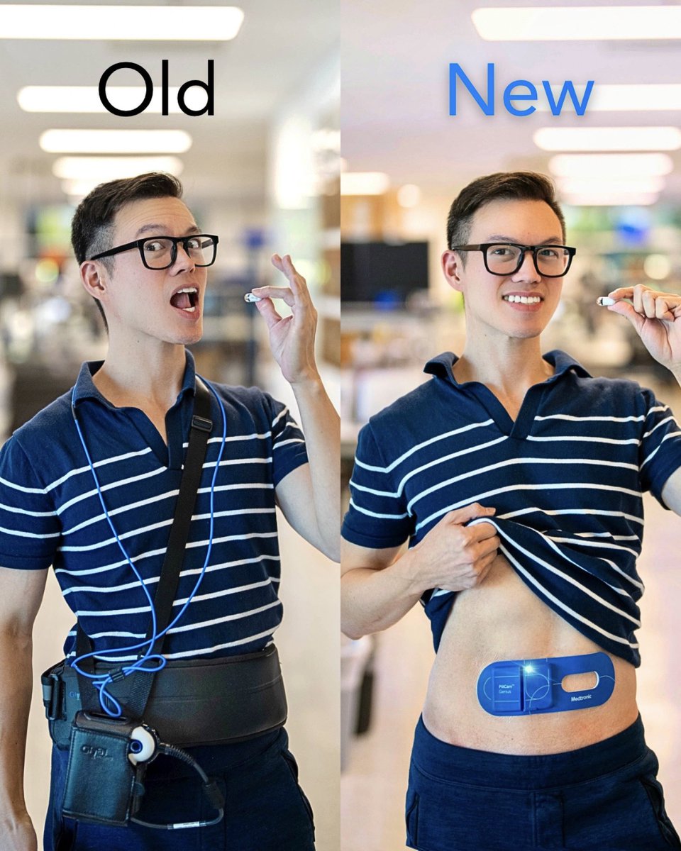🆕 SUPER excited the FDA has cleared the next gen of @Medtronic PillCam: the PillCam Genius SB Kit 🥳

Bye bulky recorder, hello adhesive patch designed for in-clinic + at-home 💊ingestion!

Better pt experience + potentially reducing equipment-limiting wait times. 🙏
#GITwitter
