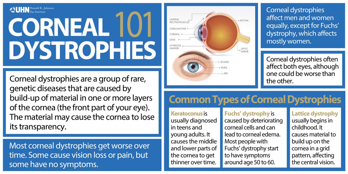 #DYK: Some individuals with #corneal dystrophies may not have any symptoms, while in others they may cause significant #vision impairment. Learn more about corneal diseases, treatment options and our current research @DKJEI_UHN >> uhn.ca/EyeInstitute #VisionHealthMonth