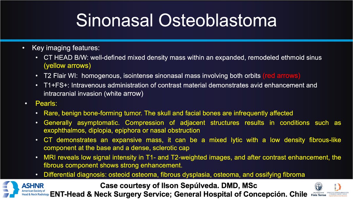 #ASHNRCOTW #253: ANSWER. Thx @iasepulveda 4 case! #ASHNR24 @callyrobs @DShatzkes @CDP_Rad @rhwiggins @nakoontz @KRileyMD @CMGlastonbury @cmtomblinson @tabby_kennedy @PhilipRChapman1 @WmOBrienDO @MohitAgNeurorad @AshokSrini15 @amyfjuliano @RadRupa @kmmosier