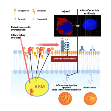 New! Online now: Diabetic retinopathy is a ceramidopathy reversible by anti-ceramide immunotherapy dlvr.it/T71zt6