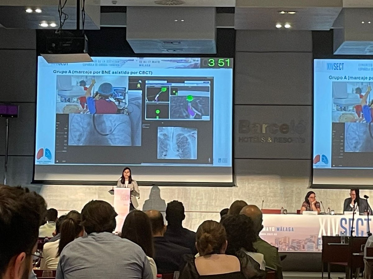 Muy contentos por haber podido presentar nuestros resultados en marcaje intraoperatorio de nódulos pulmonares en un quirófano híbrido en la sesión de mejores comunicaciones orales del congreso #SECT2024 #YoSoySECT <a href="/toracicaslm/">Cirugía Torácica Salamanca</a> <a href="/SECTtoracica/">SECT</a>
