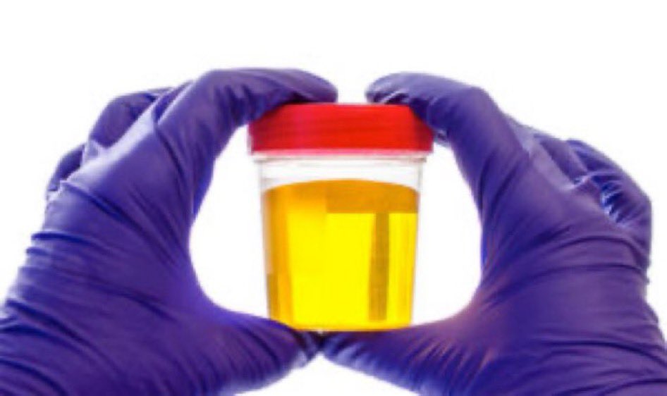 Lab grade synthetic urine #quickfix