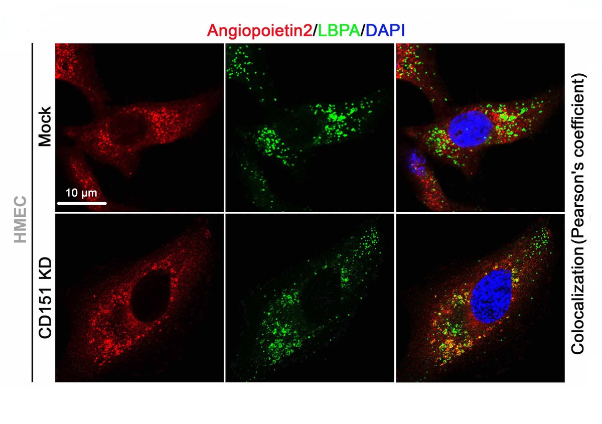 Chen et al found that regulation of the integrity of protein structure by #endosomes & #lysosomes are important for controlling the #inflammation of the #heart and blood #vessels. Learn more at ahajrnls.org/3yi4cF6 @JunxiongChen11