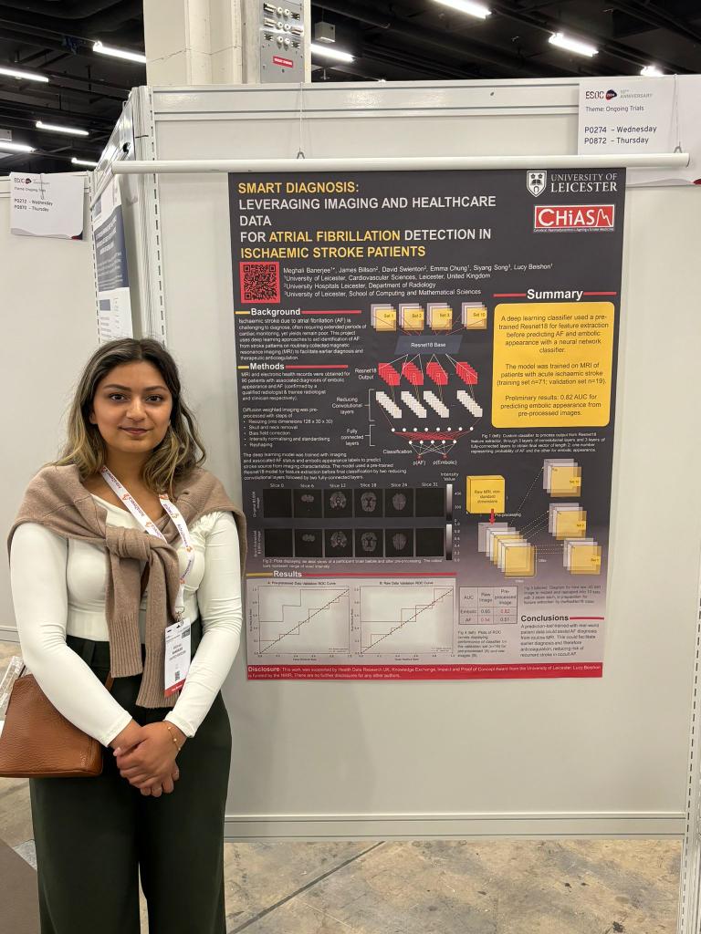 Very proud of my first PhD Student Meghali Banerjee presenting on using machine learning to diagnose embolic stroke at #ESOC2024 🥳🥳👏👏👏@@UoLCVS