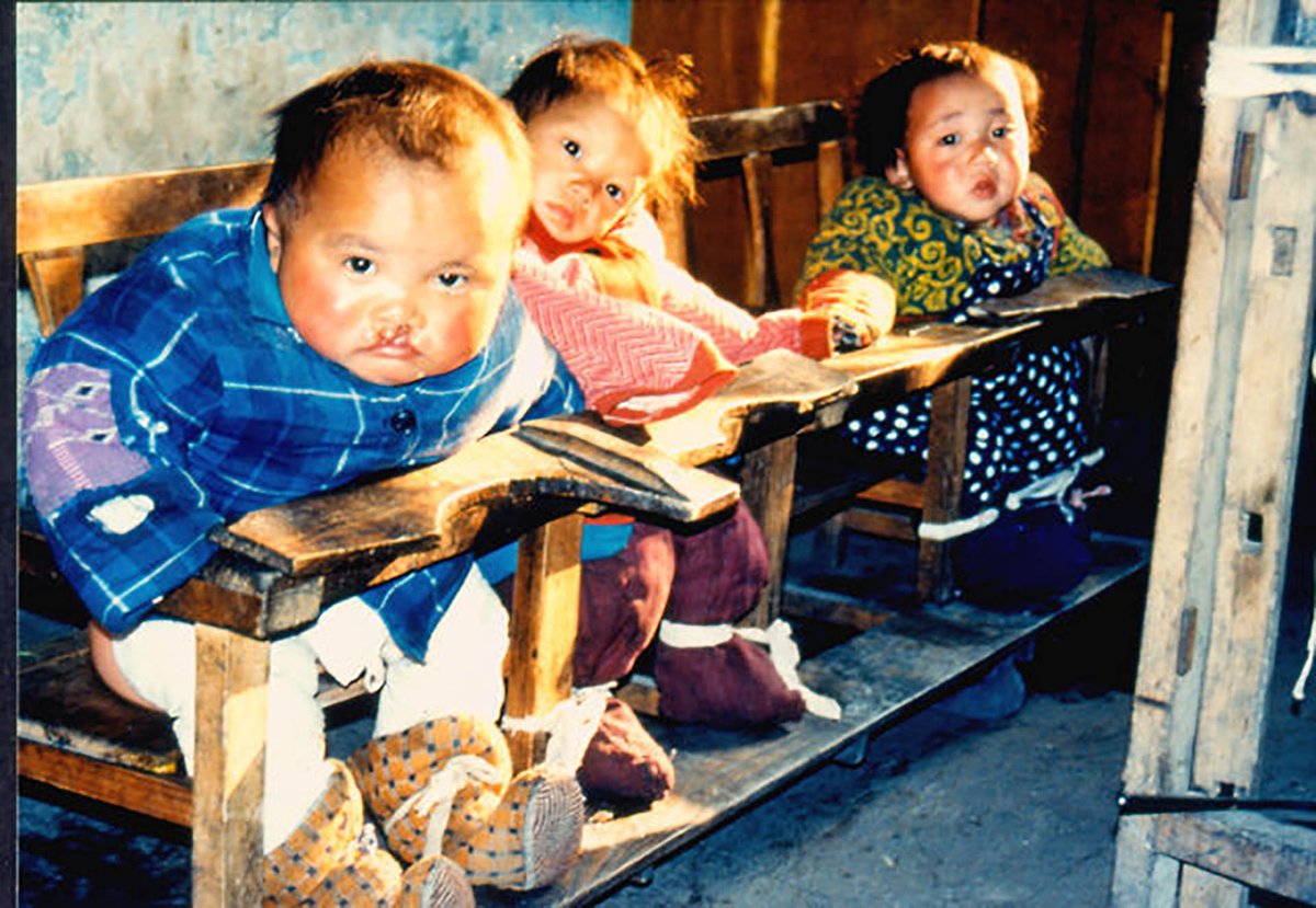 Çin'deki bir yetimhanede delikli sandalyelere bağlanmış çocuklar. Bu fotoğraf karesi, “Tek Çocuk Politikası” sırasında kız çocuklarının ve engelli çocukların ölümcül bir şekilde ihmal edilmesini konu alan bir belgeselin gizli çekimi sırasında kaydedilmiştir. 1995