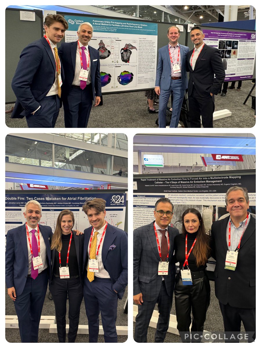 Too many posters to count from the #CedarsSinaiEP team #HRS2024! -PA Pre-Mapping & LA roof ablation 💪 🤩 -Rapid Treatment of Air Embolism- acronym T-R-A-P💪 👍 -Double Fire 2:1 AVN mistaken as AF 💪 👏 More to come….!! @MdSimsolo @NatashaCuk @CedarsSinaiMed @SmidtHeart