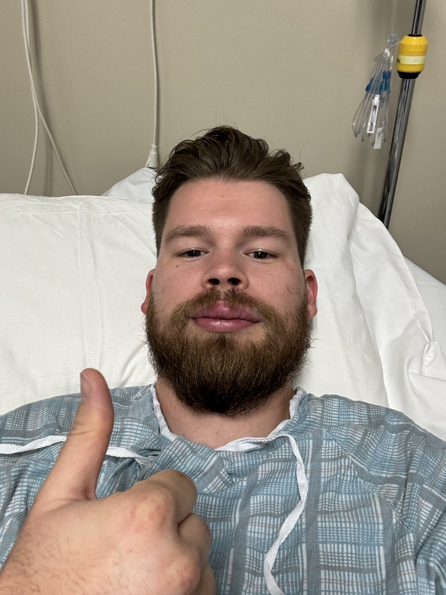 Haven’t eaten in 36hrs, surgery went fine, woke up on anesthetics asking for Chipotle  IMMEDIATELY. 

Anyways, Completely normal. No Crohns. The hunt for lip swelling continues 🤪