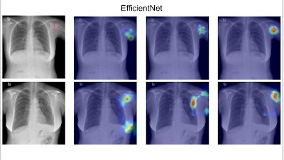 AI-assisted Analysis to Facilitate Detection of Humeral Lesions on Chest Radiographs doi.org/10.1148/ryai.2… #DeepLearning #ChestRad #MachineLearning