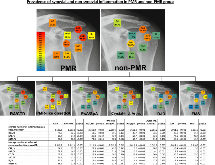 MRI of shoulder girdle in polymyalgia rheumatica: inflammatory findings and their diagnostic value ncbi.nlm.nih.gov/pmc/articles/P…