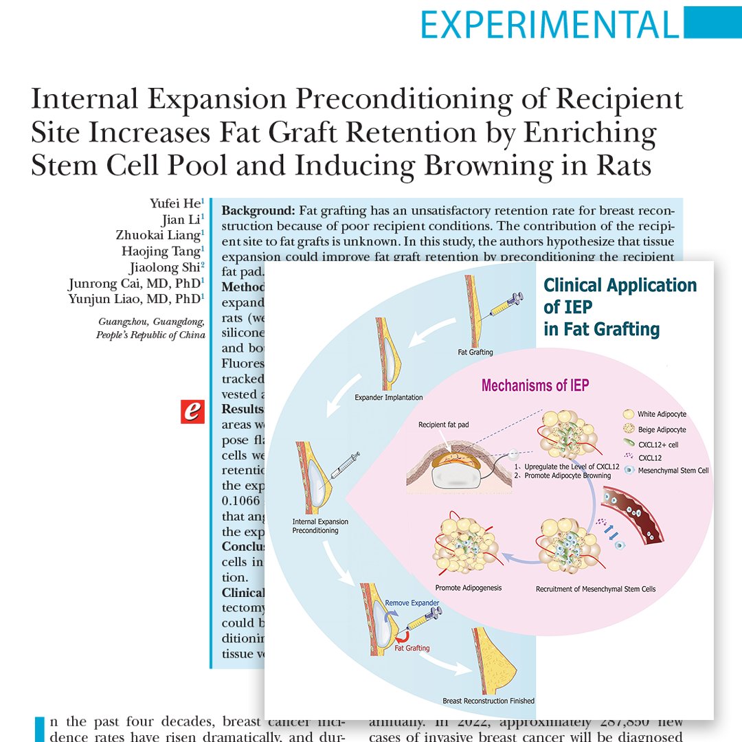 In this #PRSJournal study, the authors hypothesize that tissue expansion could improve #fatgraft retention by preconditioning the recipient fat pad. Read about it here: bit.ly/InternalExpans…