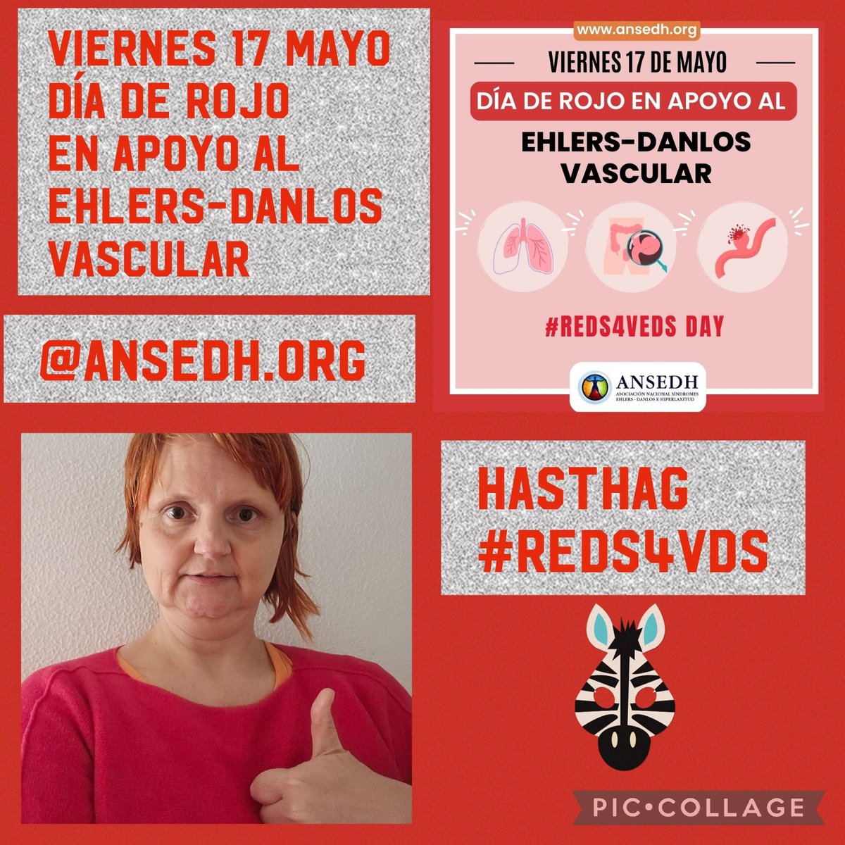 Buenas noches a todos y a todas hoy viernes 17/05/2024 me quiero unir al hasthag #reds4veds en el día rojo en apoyo al Ehlers-Danlos vascular con la Asociación @ANSEDH Como yo digo y creo en mi hasthag #siempreadelante💪🧡🦓