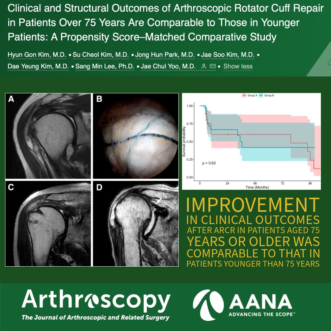 What are the outcomes of arthroscopic rotator cuff repair in patients 75 years of age and older? 
ow.ly/fcqp50RVMGS  #OrthopedicSurgery #RotatorCuff #ArthroscopicSurgery #AgingWell