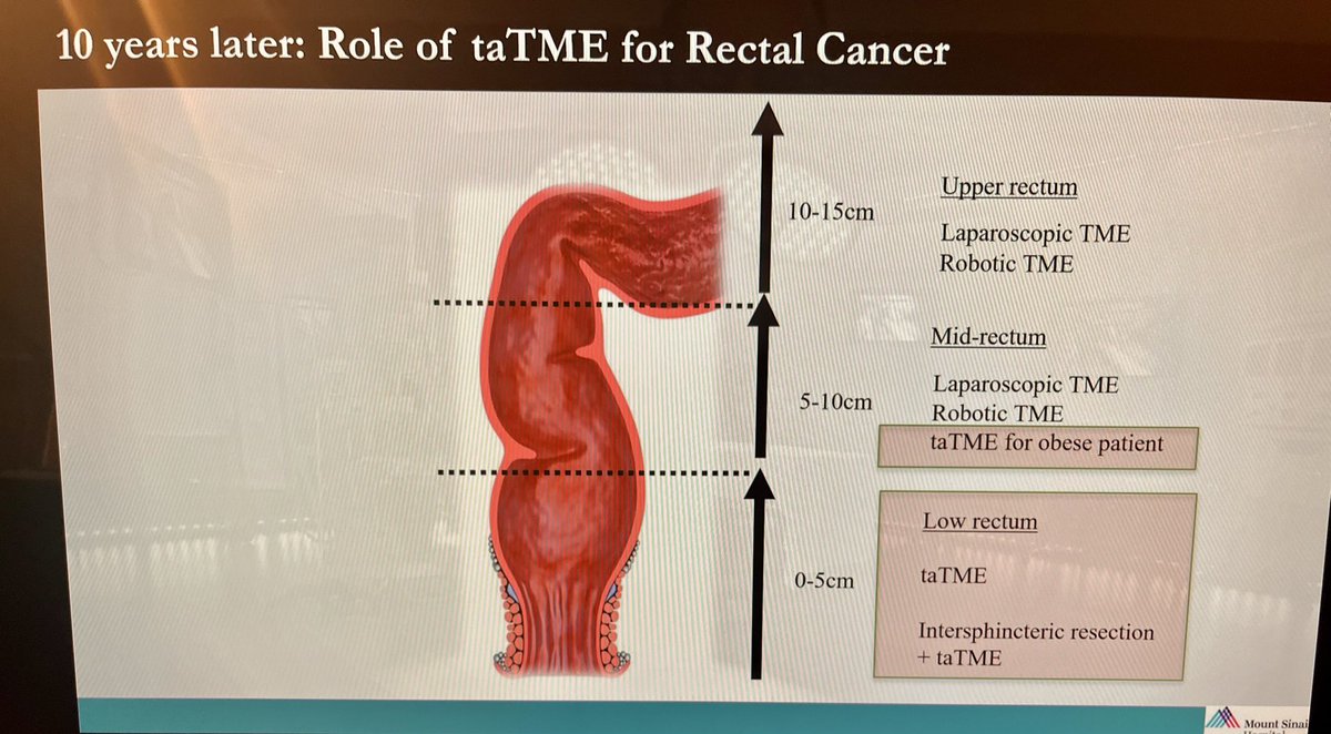 Salvador Morales Conde (@smoralesconde) on Twitter photo Colorectal course at <a href="/IrcadFrance/">IrcadFrance</a>
Interesting the opinion of P Sylla about the indication of TaTME today
During the discussion you can see a trend - robotic has taking over the indication of TaTME even in many medium a low rectal cancer
Future will tell us Colorectal course at <a href="/IrcadFrance/">IrcadFrance</a>
Interesting the opinion of P Sylla about the indication of TaTME today
During the discussion you can see a trend - robotic has taking over the indication of TaTME even in many medium a low rectal cancer
Future will tell us