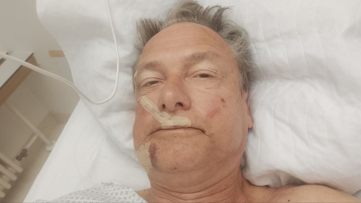 Michael #Stürzenberger meldet sich zu seinen Verletzungen: »Es war richtig knapp gestern. Gerade kamen vier Ärzte zur Visite. Lebensgefährlich hätte der Stich seitlich in die Brust werden können, der Richtung Lunge ging. Der Stich in den Oberschenkel traf Venen und
