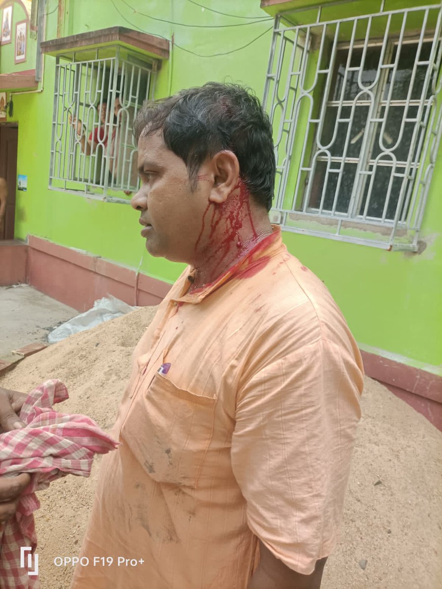 Dedicated BJP worker Akhil Manna injured by TMC goons deadly attack, he is Admitted in ICU now . Location - Diamond Harbour, Satgachiya @amitmalviya @sunilbansalbjp @mangalpandeybjp @AshaLakra79 @JPNadda @AmitShah @narendramodi @blsanthosh