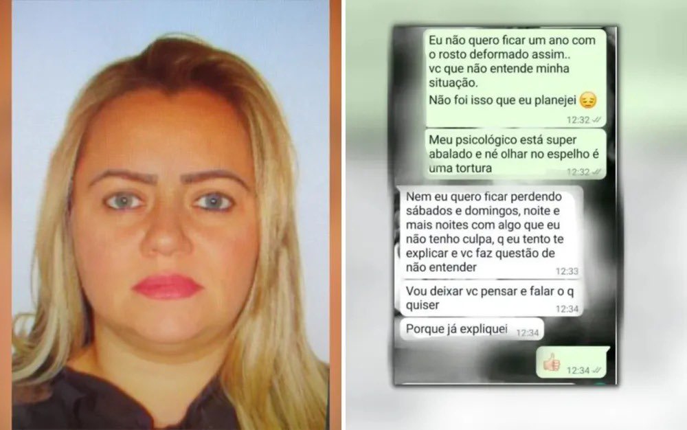 g1goias's tweet photo. Mulher chora ao falar de sequelas após fazer procedimento estético com enfermeira indiciada por deixar pacientes deformadas
==> https://t.co/9wEVHE3ebc
#g1go #goiânia #polícia #vítimas #procedimentos https://t.co/pjLs7OgmNq