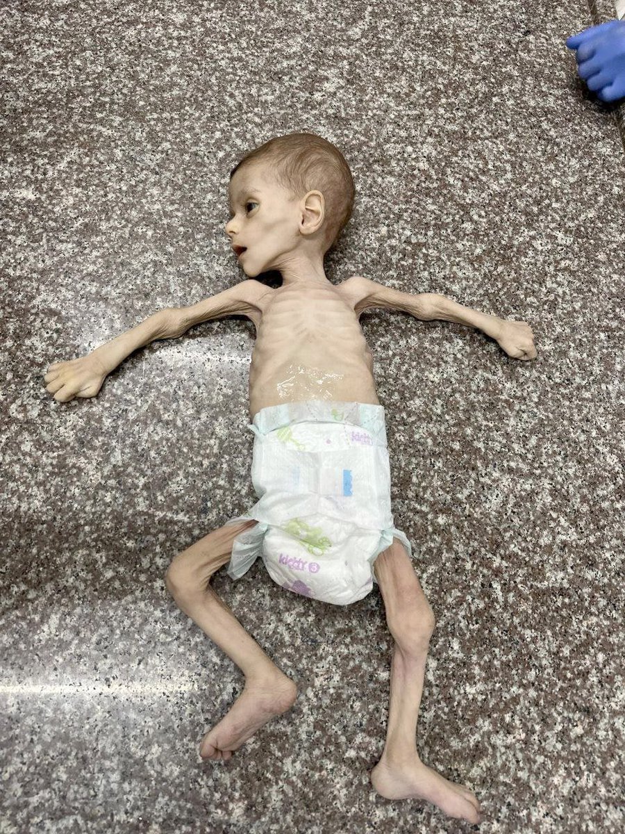 Bugün Gazze'de bir bebek daha açlıktan vefat etti. #GazaGenocide‌