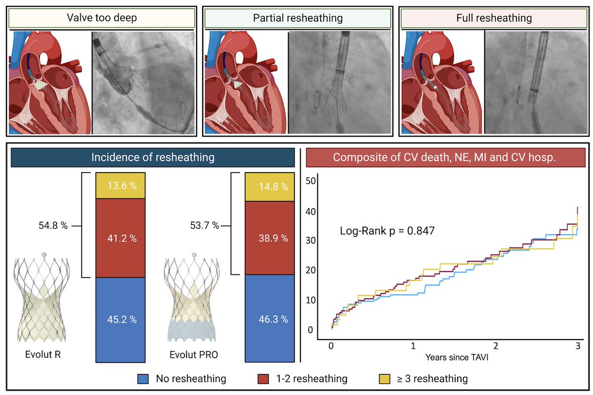 Francesco Bianchini (@bianchinifra92) on Twitter photo Glad to share our latest paper about the clinical impact of multiple resheathing during TAVI with Evolut!!!
International Journal of Cardiology
doi.org/10.1016/j.ijca…
Thanks to <a href="/BURZOTTA_F/">FRANCESCO BURZOTTA</a>, <a href="/CristinaAuri17/">Cristina Aurigemma</a>, Carlo Trani, Enrico Romagnoli, <a href="/Emiliano_Bi2/">Emiliano Bianchini</a>, <a href="/MarcoBusco46401/">Marco Busco</a> Glad to share our latest paper about the clinical impact of multiple resheathing during TAVI with Evolut!!!
International Journal of Cardiology
doi.org/10.1016/j.ijca…
Thanks to <a href="/BURZOTTA_F/">FRANCESCO BURZOTTA</a>, <a href="/CristinaAuri17/">Cristina Aurigemma</a>, Carlo Trani, Enrico Romagnoli, <a href="/Emiliano_Bi2/">Emiliano Bianchini</a>, <a href="/MarcoBusco46401/">Marco Busco</a>