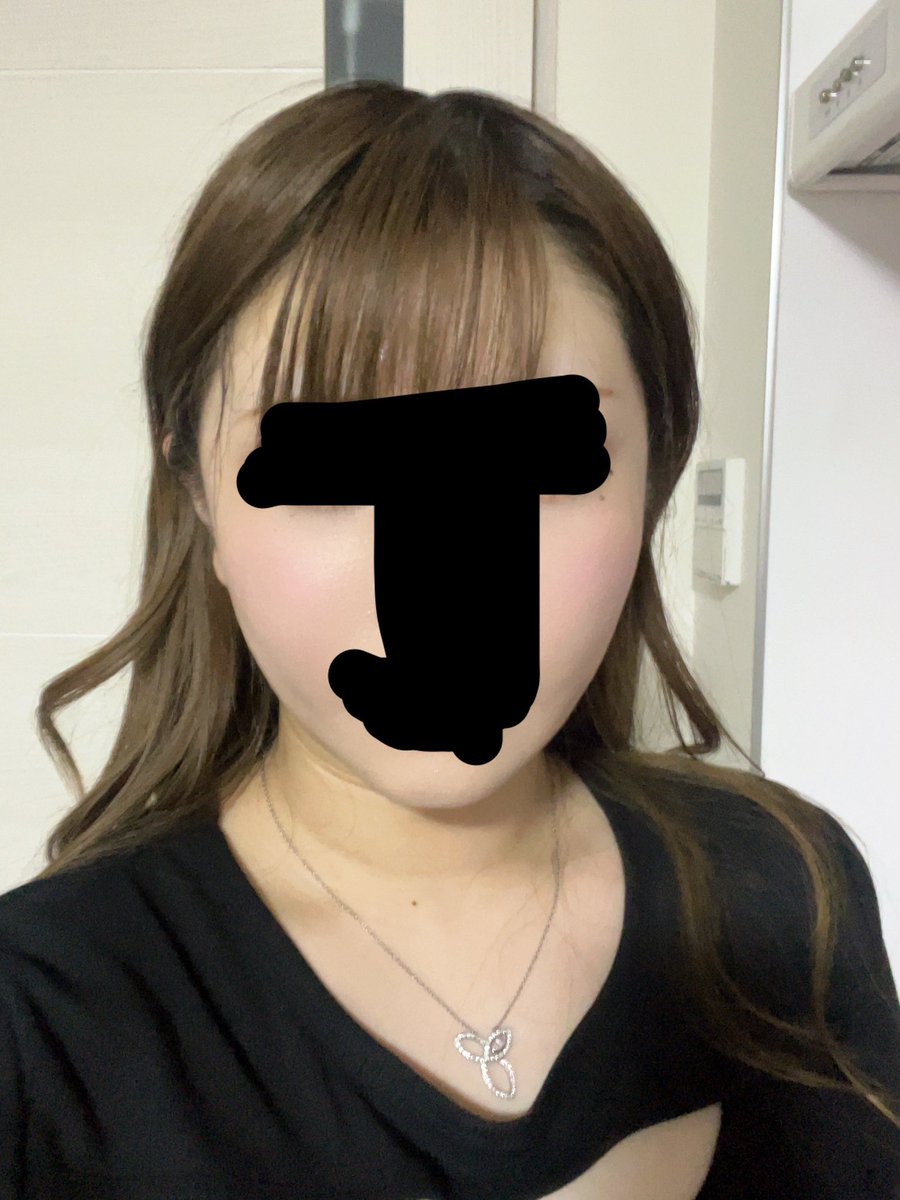 neko__prpr's tweet photo. セギム美容外科で輪郭して3ヶ月目です！術前→2ヶ月後→3ヶ月の今です。
頬のパンパン具合が気になって写真をあまり撮らなかったのですが3ヶ月目の写真を撮ったらかなりスッキリしてて、輪郭がハッキリとでてきました🙏🏻
まだまだ口周り違和感ありますが半年〜1年気長に経過観察します！ https://t.co/1qsT7Sprqi