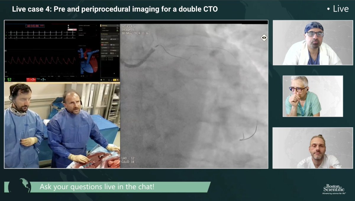 CTO LIVE AID (@cto_liveaid) on Twitter photo 🎥 Slot 2 is streaming right now featuring live case 3 from Institut of Cardiology, Warsaw, in Poland and live case 4 from Ziekenhuis Netwerk Antwerpen, in Belgium.
Tune in now and be part of this amazing event  ➡️ swll.to/N14D7
#CTOLIVEAID2024 #Cardiology 🎥 Slot 2 is streaming right now featuring live case 3 from Institut of Cardiology, Warsaw, in Poland and live case 4 from Ziekenhuis Netwerk Antwerpen, in Belgium.
Tune in now and be part of this amazing event  ➡️ swll.to/N14D7
#CTOLIVEAID2024 #Cardiology