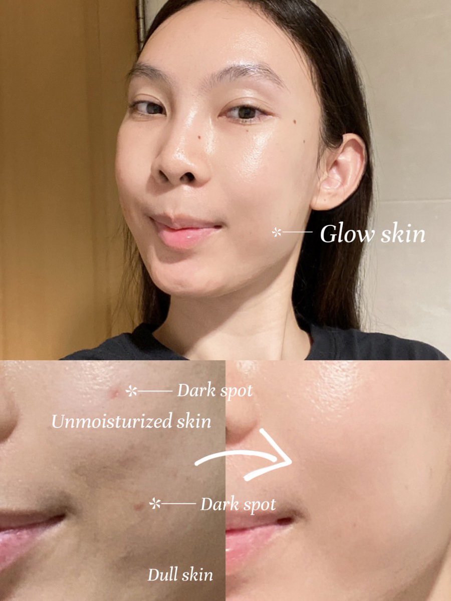 polypeelo's tweet image. #ใช้ตามอินฟูล พี่โค่ @echopwt_ ยกตัวนี้ให้เป็น Master of Dark spots เลยแม๊!! 7 วัน รอยดำสิวจาง!! จริงๆนางปราบจุดด่างดำฝังลึกด้วยนะ ยิ่งรอยสิวที่เพิ่งเป็นโบกนางเยอะๆ จางไวมากกก ก หน้าใสขึ้นจริง!! ใครรอยเยอะอย่าเพิ่งท้อ นอกจาก pico ก็โบก Vichy liftactiv b3 serum ตัวนี้ละ เริ่ด!!