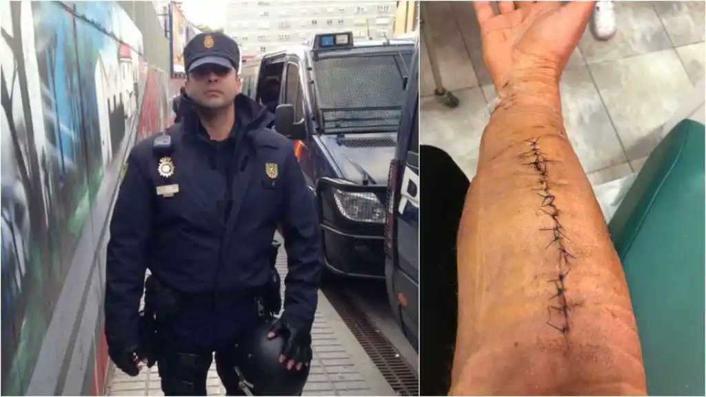 🔴 '¿A mí qué amnistía me devuelve el brazo?': Ángel, policía retirado por las secuelas que le dejó el 1-O.
