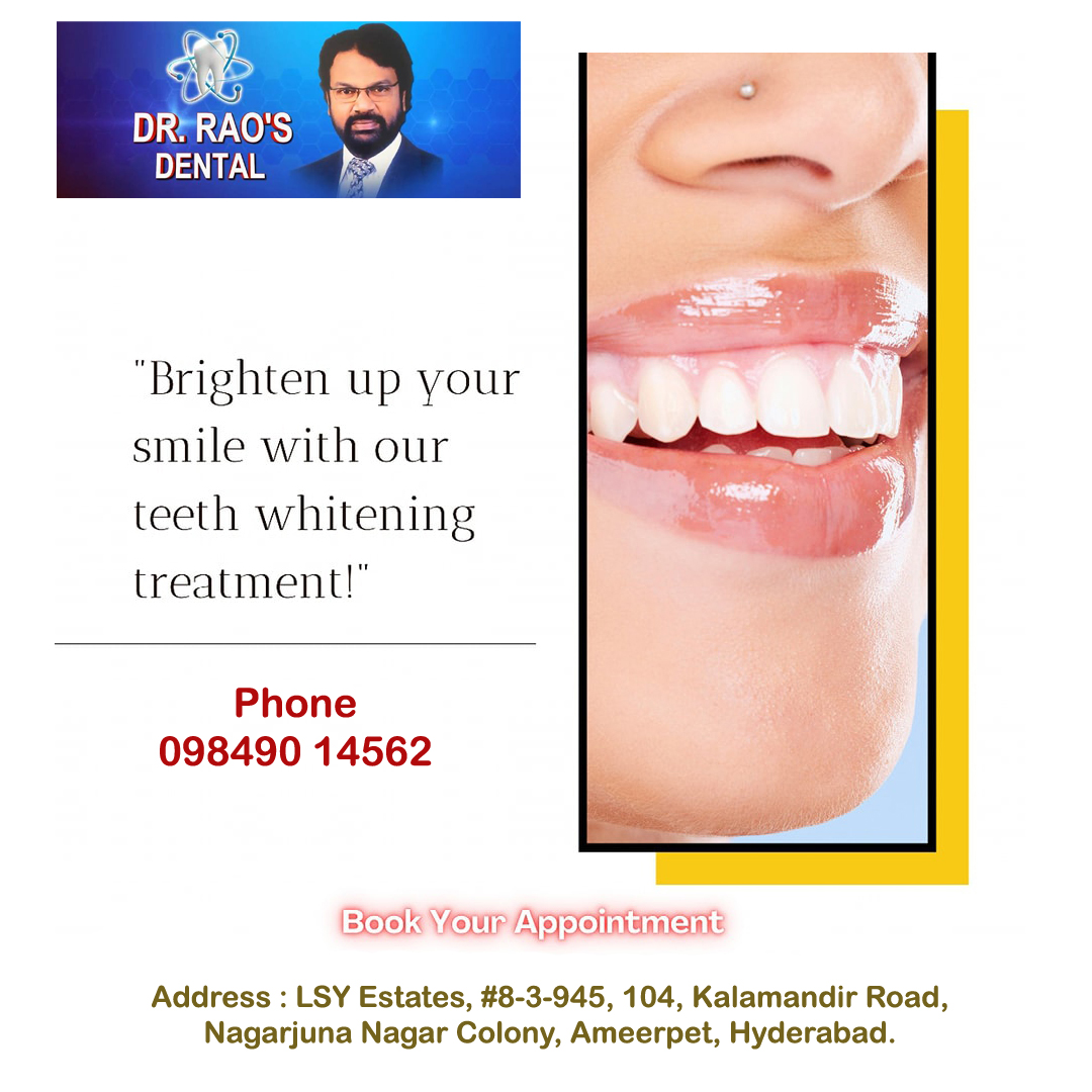 Best Dental Hospital In Ameerpet. #Ameerpet #panjagutta #ameerpetdentist #ameerpetschools #dentalclinics #dentists #imagehospitals #dental #Dentist #dentistry #cosmeticdentistry #Panjagutta #srnagar #krishnanagar #srinagarcolony #ameerpetshopping #ameerpetstudents #notobacco