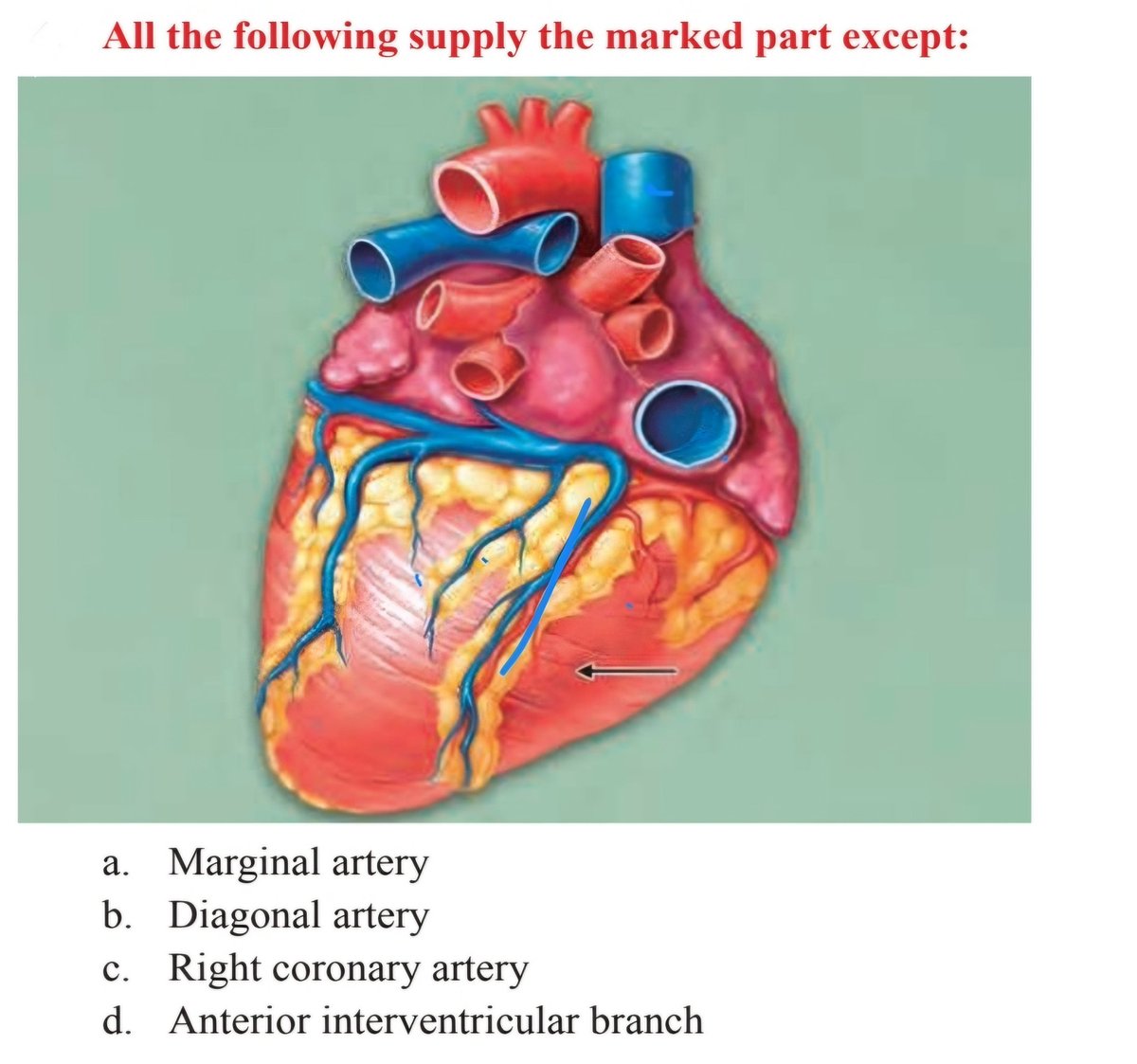 Comment your answer? 

#NEET #USMLE #INICET .#MEDX :