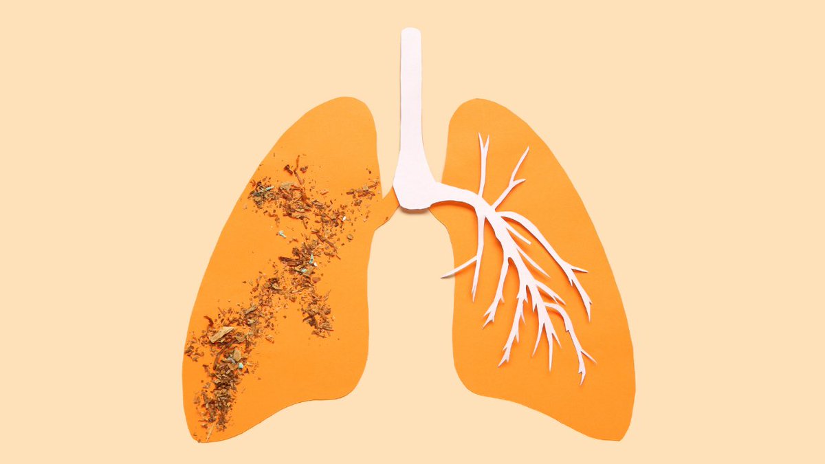 🫁 El cribado de #CáncerDePulmón en pacientes con #EPOC revela la posibilidad de diagnosticar el tumor en etapas tempranas, con potencial curativo Estos hallazgos de @ClinicaNavarra representan un avance prometedor en el tratamiento 📑 i.mtr.cool/gqvmzpmurn