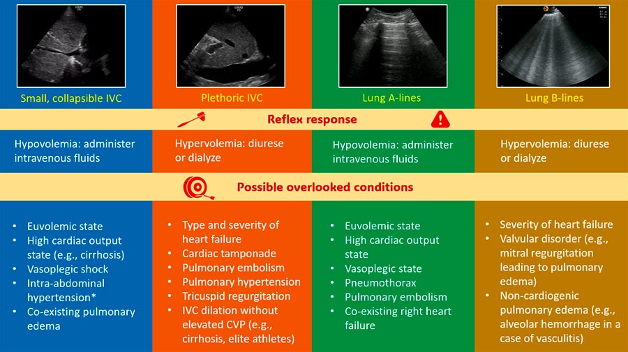 Pitfalls of excessive reliance on individual organ #POCUS and knee-jerk clinical decision-making.
#FOAMed #Nephpearls #MedEd 
karger.com/bpu/article/do…