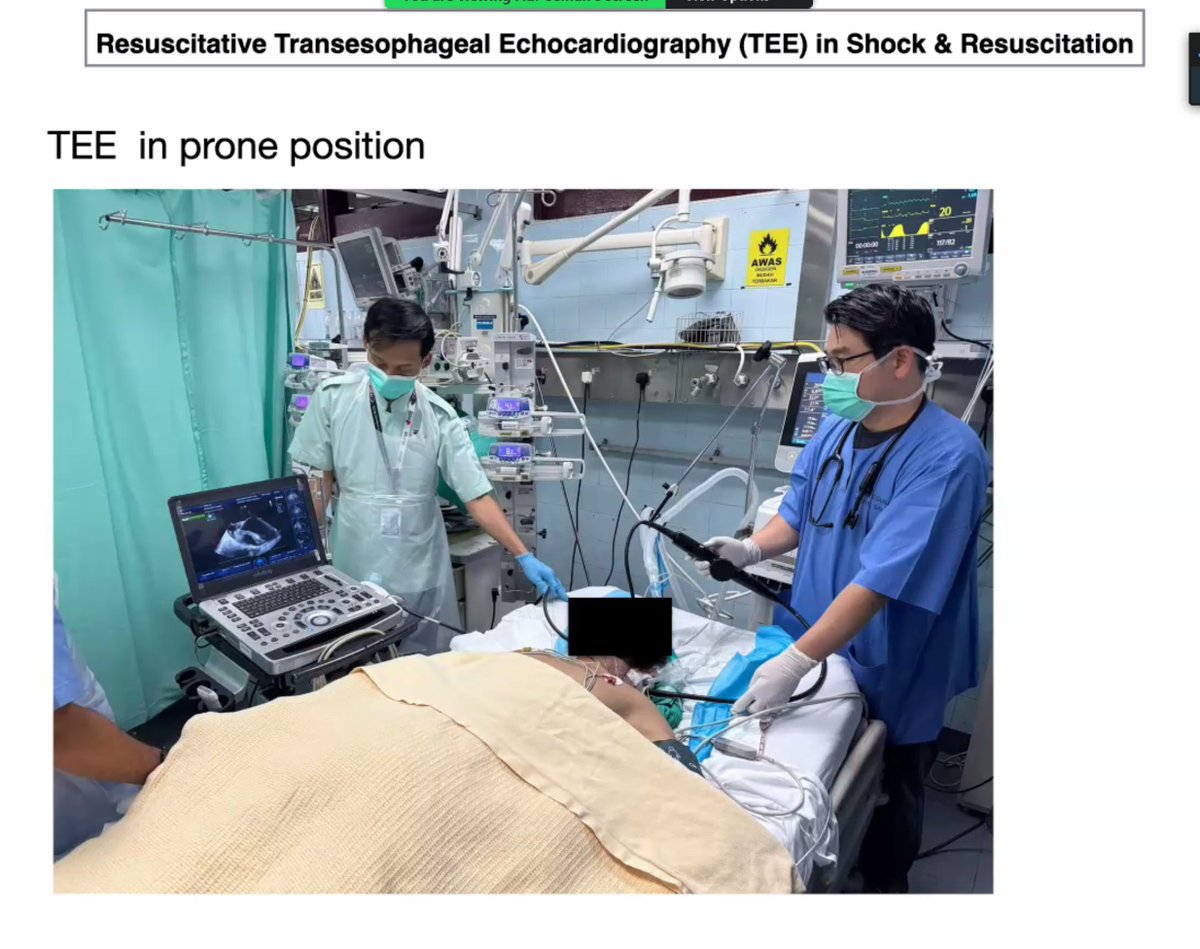 So EM Malaysia - TEE in shock. Amazing training and setup from Dr Adi Osman. #POCUS #ECHOfirst @ResusTEEproject @WINFOCUS