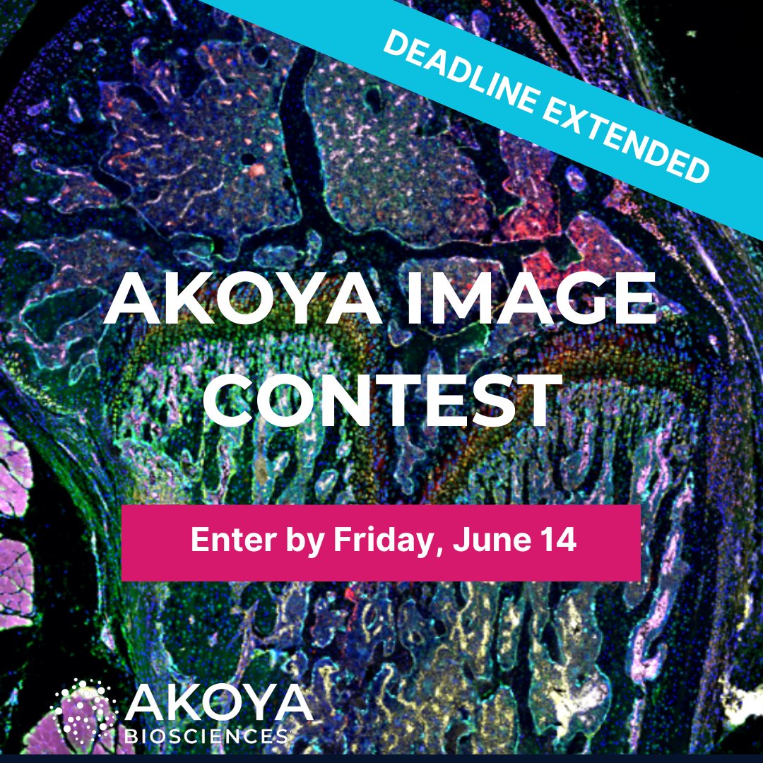 🖌️ Does your tissue image make you feel like a lab Picasso? Enter the Akoya Image Contest for a chance to win a $100 Amazon gift card & social media fame. Deadline now June 14! Submit your masterpieces here: bit.ly/3TfdR7x And see your name here ↩️ 📸 Will Wei Qiao
