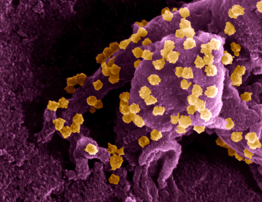 The oral compound #obeldesivir potently suppresses a range of #coronaviruses, including #SARSCoV2 and #MERSCoV, in mice—supporting its potential as a broad, RdRp-targeting antiviral for current and future pandemic threats. @ScienceTM scim.ag/78D