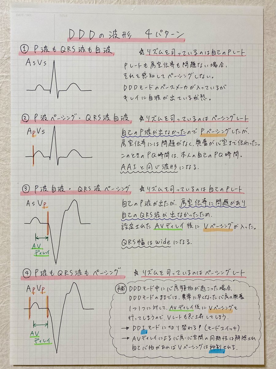 心リハPTせこ tweet media
