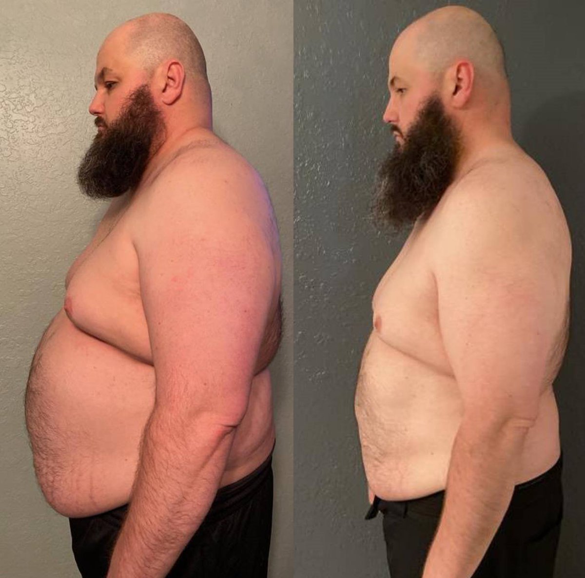 Adam has lost 80lbs so far WITHOUT going to the gym

- Been overweight his entire life

- Super hectic job (manages 20 employees)

- Didn’t believe sustainably losing weight was even possible for him.