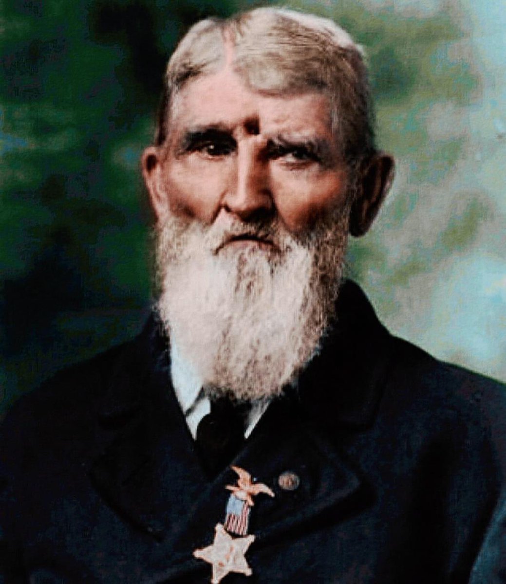 Pictured here is American Civil War veteran Jacob Miller, in 1911, with a bullet hole in his head that he obtained during the Battle of Chickamauga in 1863. Left for the dead, the Union soldier regained consciousness and ended up living for another 54 years. Metal as F.
