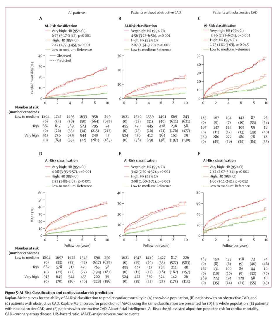 JCLRodrigues's tweet photo. Fantastic to see the game-changing #ORFAN #yeSCCT study using ⁦@CaristoHeart⁩ technology published in ⁦@TheLancet⁩ https://t.co/iN4gekyGbg. It was a privilege to contribute data from ⁦⁦@RUHBath⁩. Thanks ⁦@Charis_Oxford⁩ for the opportunity. https://t.co/y8GbNu1fD9